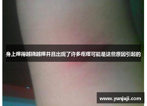 身上痒得越挠越痒并且出现了许多疙瘩可能是这些原因引起的